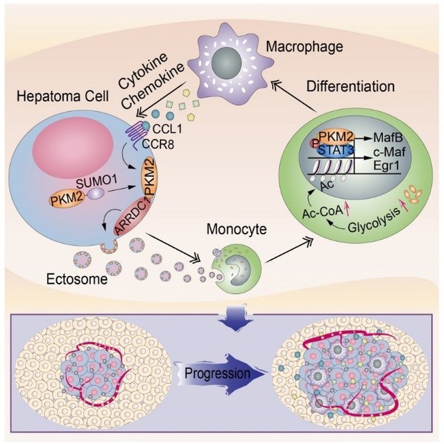 Ectosomal PKM2 Promotes HCC by Inducing Macrophage Differentiation and Remodeling the Tumor Microenvironment