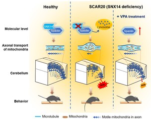 [National Science Review] SNX14 deficiency-induced defective axonal mitochondrial transport in Purkinje cells underlies cerebellar ataxia and can be reversed by valproate
